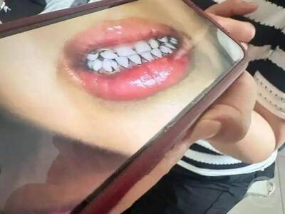 自由開講》中國爆鉛中毒 「 一個孩子的命有多重？」