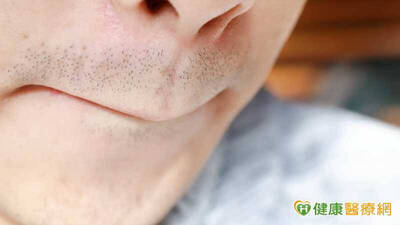 健康醫療網》男鬍子變濃竟和「天天DIY」有關？ 醫搖頭：2關鍵決定