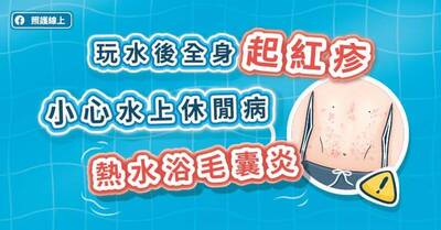 照護線上》玩水後全身起紅疹，小心水上休閒病──熱水浴毛囊炎（圖文懶人包）