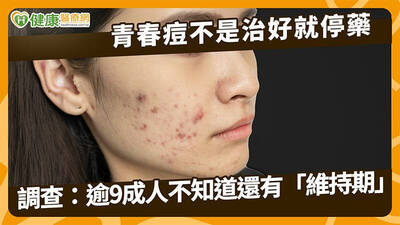 健康醫療網》青春痘不是治好就停藥 調查：逾9成人不知道還有「維持期」
