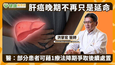 健康醫療網》肝癌晚期不再只是延命 醫：部分患者可藉1療法降期爭取後續處置