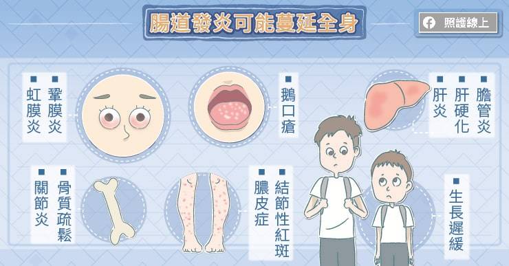 照護線上》壓力悶燒「拉」警報!持續腸炎恐蔓延全身