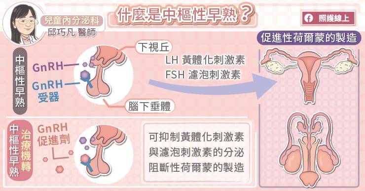 照護線上》中樞性早熟治療,不會影響未來的生育能力,兒童內分泌醫師圖文解析