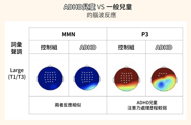 不同腦波成分，會反應不同的大腦機制。與音調敏感度有關的 MMN ， ADHD 兒童和一般孩子差不多；但與注意力有關的 P300， ADHD 孩子反應明顯較差。（資料來源│李佳穎）