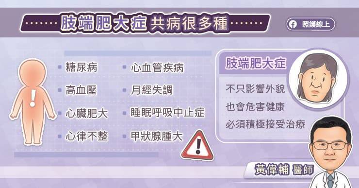 照護線上》肢端肥大症會改變外貌、危害健康，積極治療才能維持生活品質，內分泌專科醫師圖文解說