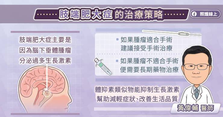 照護線上》肢端肥大症會改變外貌、危害健康，積極治療才能維持生活品質，內分泌專科醫師圖文解說