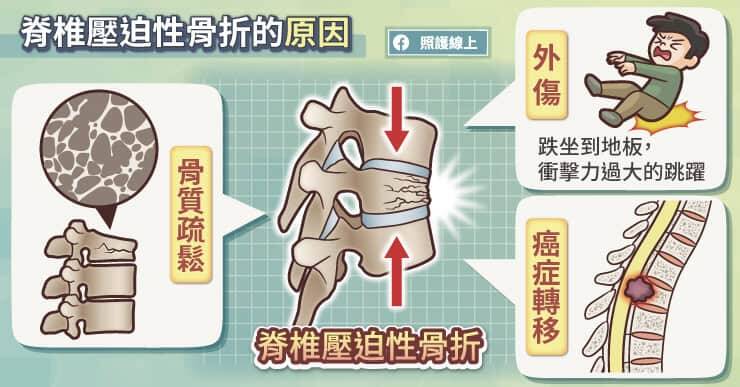 （取自貼文）