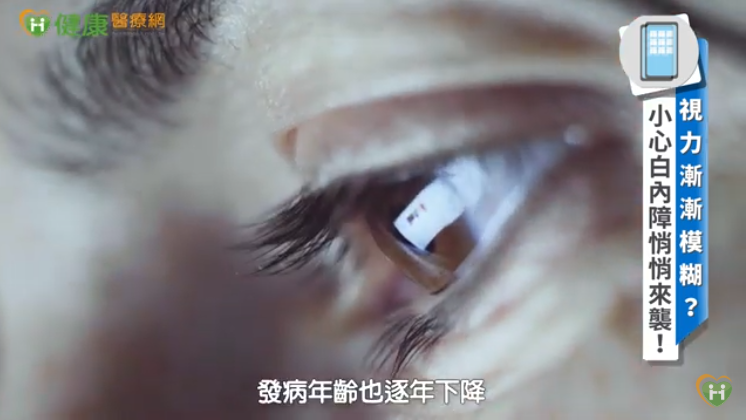 白佳欣眼科診所主任醫師傅預登指出，白內障好發於50歲以後，但若有高度近視或糖尿病等共病，可能更早出現。（取自貼文）