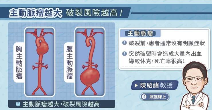 腹主動脈瘤突然破裂會引發劇烈疼痛、大量內出血，迅速導致休克甚至死亡。（取自貼文）