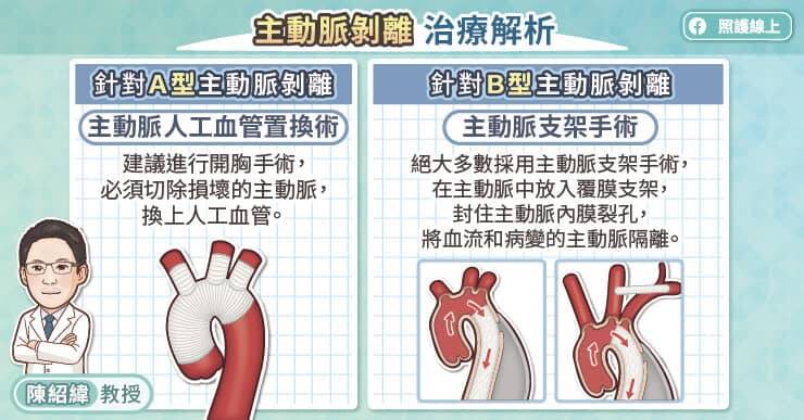 甲型主動脈剝離（Type A）的治療以開放式手術為主，乙型主動脈剝離（Type B）的治療方式包括藥物控制與微創主動脈支架置放手術。（取自貼文）