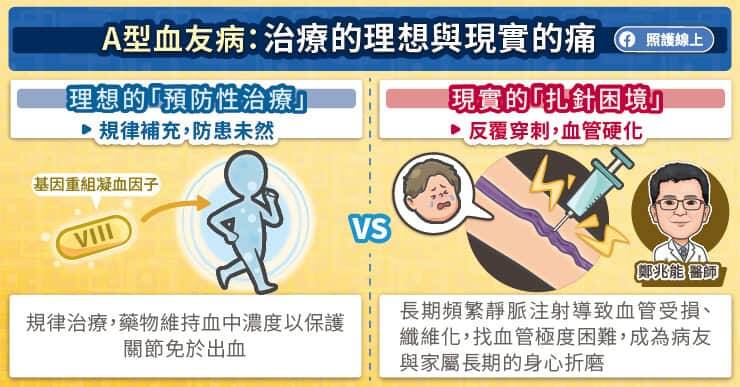 不論是血管極細的幼童，或是需長期接受治療的成年病友，頻繁穿刺靜脈會造成血管壁受損、纖維化，血管甚至會整段硬化，導致回血困難與入針極度艱辛。（取自貼文）
