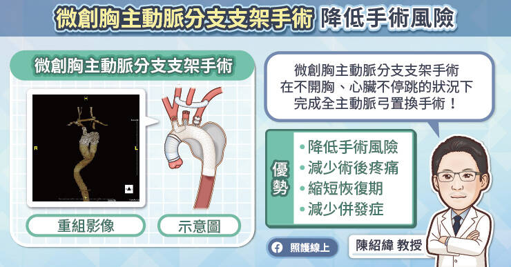 陳紹緯教授解釋，相較於傳統大開胸手術，微創主動脈支架手術能夠透過大腿股動脈進入，將支架精準放置於病灶處。（取自貼文）