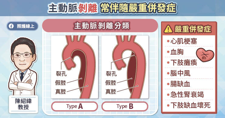 主動脈剝離依據撕裂的位置分為A型與B型。A型剝離涉及升主動脈，由於鄰近心臟，極易導致心包填塞、急性心肌梗塞或主動脈瓣膜逆流，死亡率很高，必須在確診後進行緊急開胸手術以拯救生命。（取自貼文）