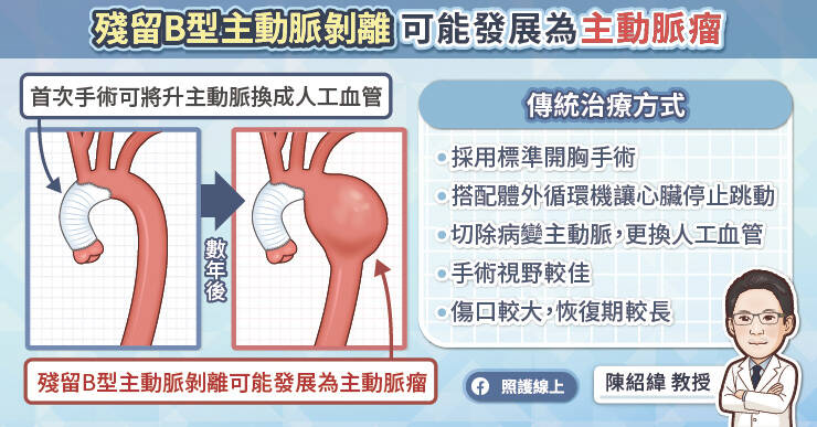 陳紹緯教授表示，接受半主動脈弓置換手術的病患可能在手術後數年後，因為殘留在遠端剝離腔擴大，漸漸演變成主動脈瘤。（取自貼文）