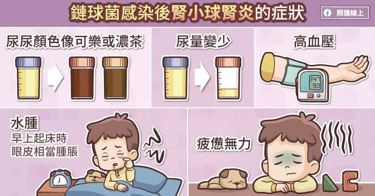 鏈球菌感染後腎小球腎炎症狀有尿液顏色很深、水腫、疲憊無力及尿量愈來愈少。（取自貼文）